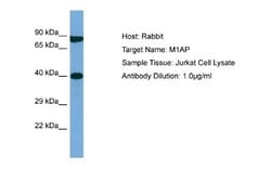 M1AP Antibody, Novus Biologicals 100 &mu;L; Unconjugated:Antibodies, Polyclonal